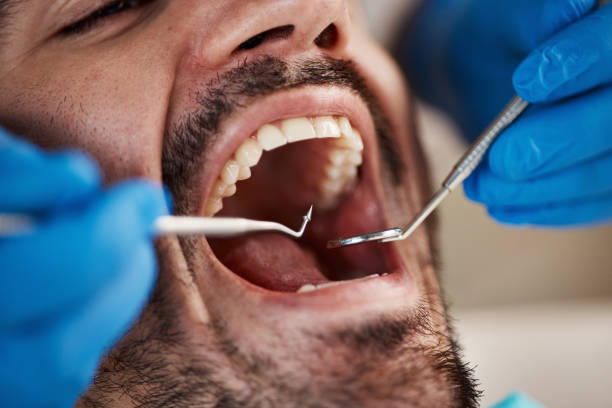Best Emergency Root Canal Treatment in Christopher, IL